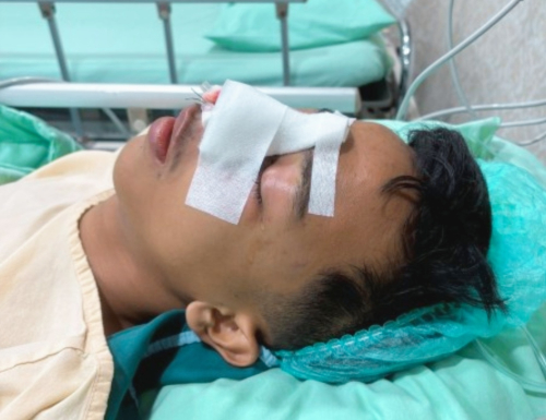 Tanggapi Serius Dugaan Perundungan dan Pemukulan Siswa di SMAN 9 Pekanbaru, Gubri Minta Diselesaikan Dengan Damai